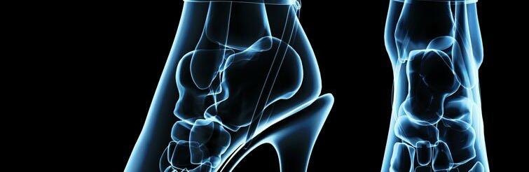 Прем’єр-міністр Великої Британії: Будь-яка мирна угода з росією потребує згоди України