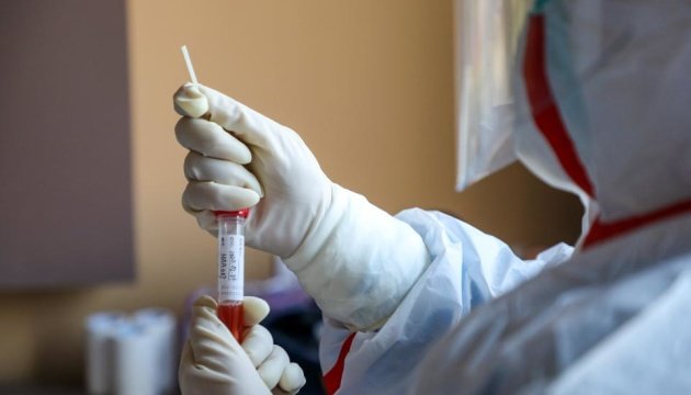  У Запоріжжі оголосили про першу підозру захворювання на коронавірус