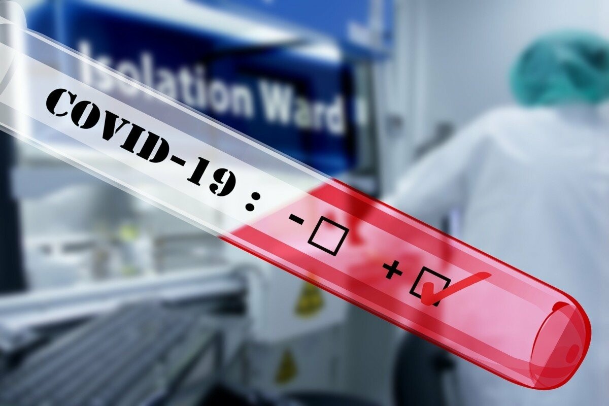 У Запорізькій області вже 300 випадків ураження на COVID-19