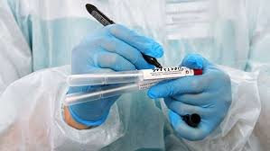 На Запоріжжі за добу п’ятеро захворіли на COVID-19, а шестеро одужали 