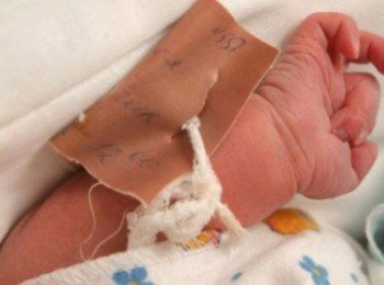 В Акимовском районе первое пополнение - родилась девочка