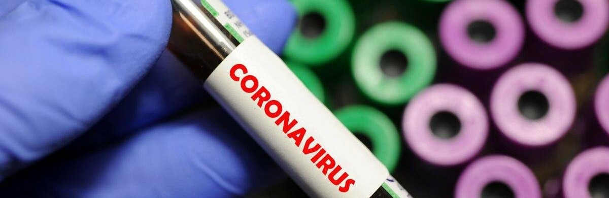 Нові дані щодо інфікованих на коронавірус у Запорізькій області Нові дані щодо інфікованих на коронавірус у Запорізькій області