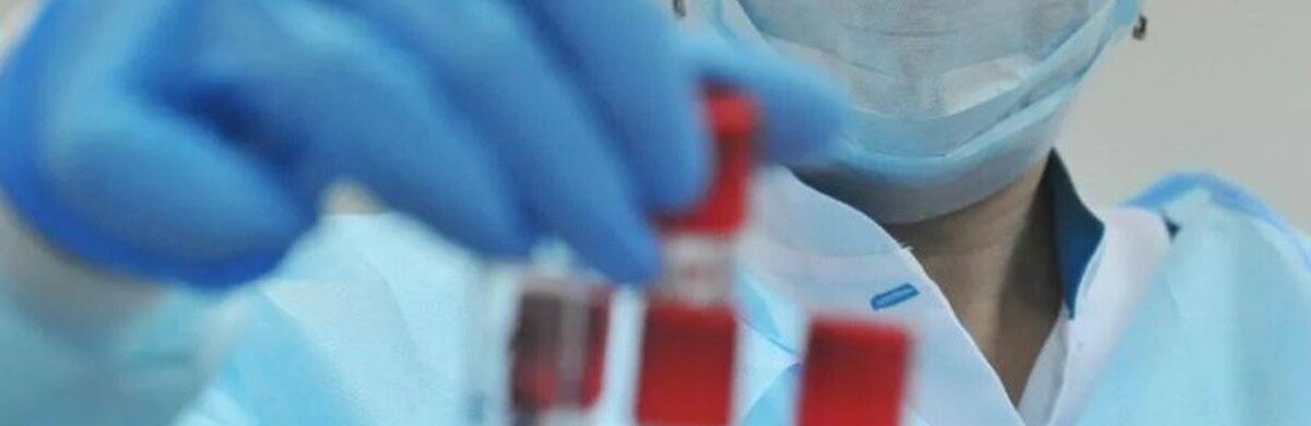 На Запоріжжі вже 115  випадків захворювання на коронавірус  На Запоріжжі вже 115  випадків захворювання на коронавірус