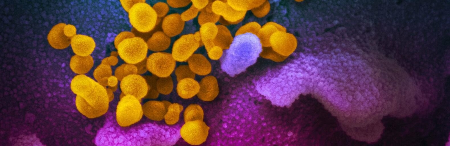 В України незабаром оголосять подовження карантину