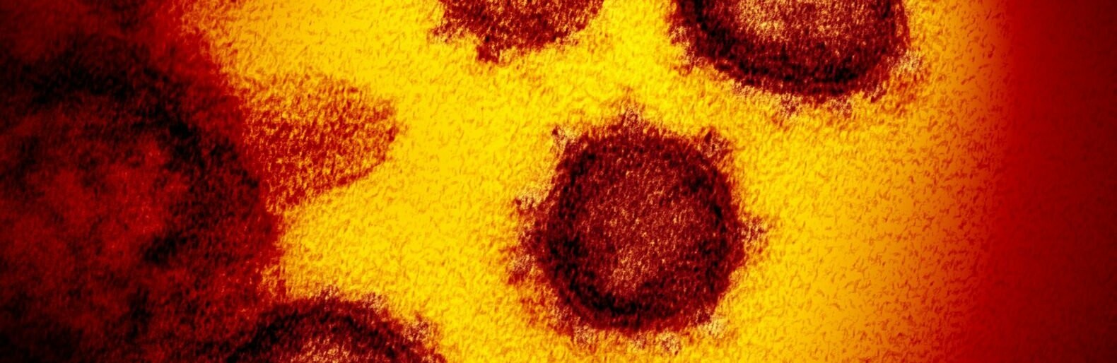 В Україні пік захворюваності на коронавірусу припаде на початок травня