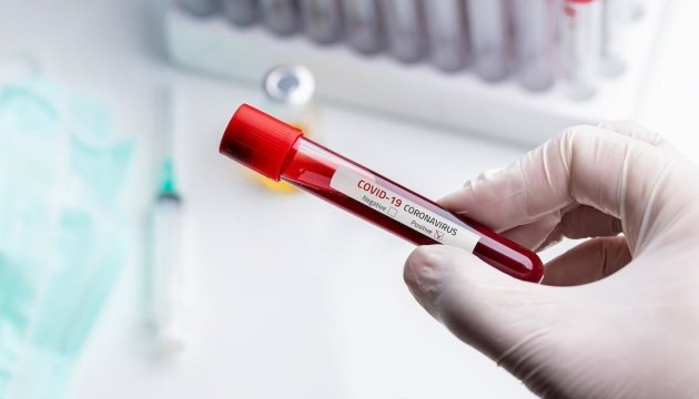   Кількість хворих на коронавірус в Україні постійно зростає