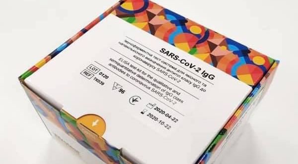 В Україні стали виготовляти власні ПЛР-тести В Україні стали виготовляти власні ПЛР-тести