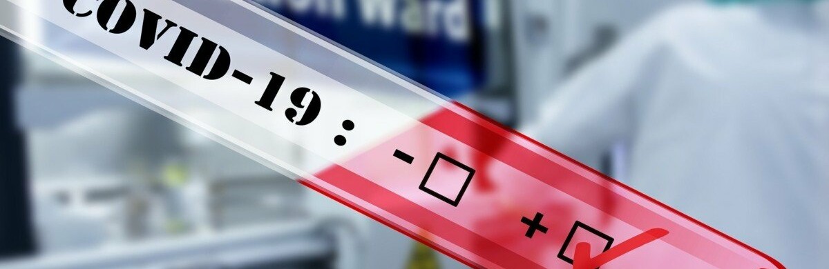 У Запорізькій області вже 300 випадків ураження на COVID-19