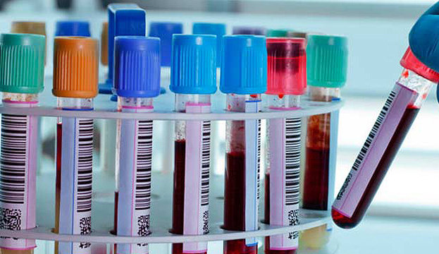 Запоріжжя продовжує залишатися головним вогнищем коронавірусу в області