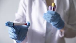 За добу в Україні додалось ще більш ніж півтисячі хворих на коронавірус