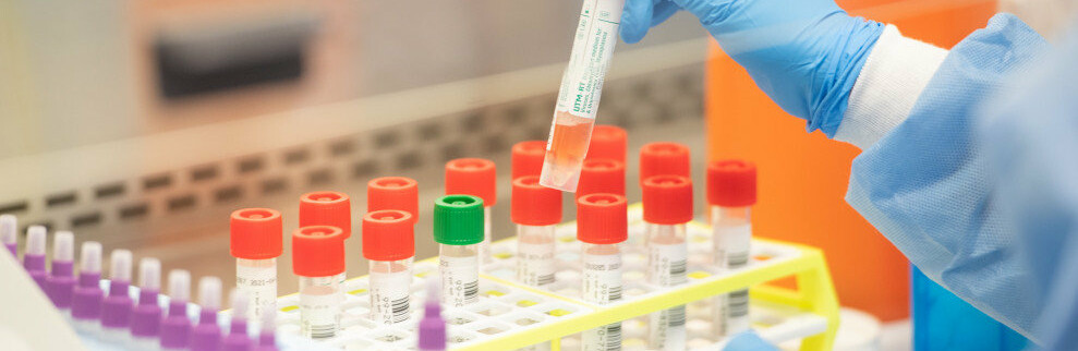 В Україні черговий антирекорд  захворювань на коронавірус за добу – майже 1000