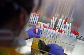 На Запоріжжі знову виявилися нові хворі на COVID-19 серед яких і медики